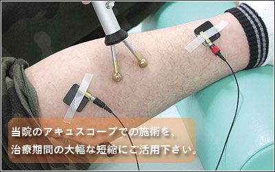 肉離れの早期治療とリハビリはしげむら整骨院へ